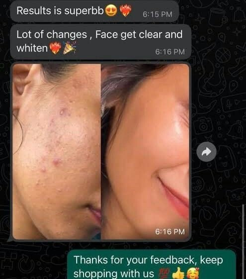 Kit Anti-Imperfections Visage